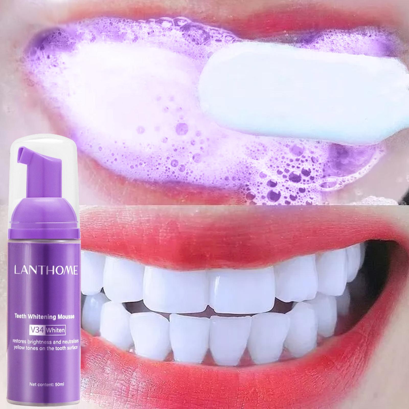 Teeth Whitening Crest - V34 Mousse Teeth Cleaning Toothpaste Effective