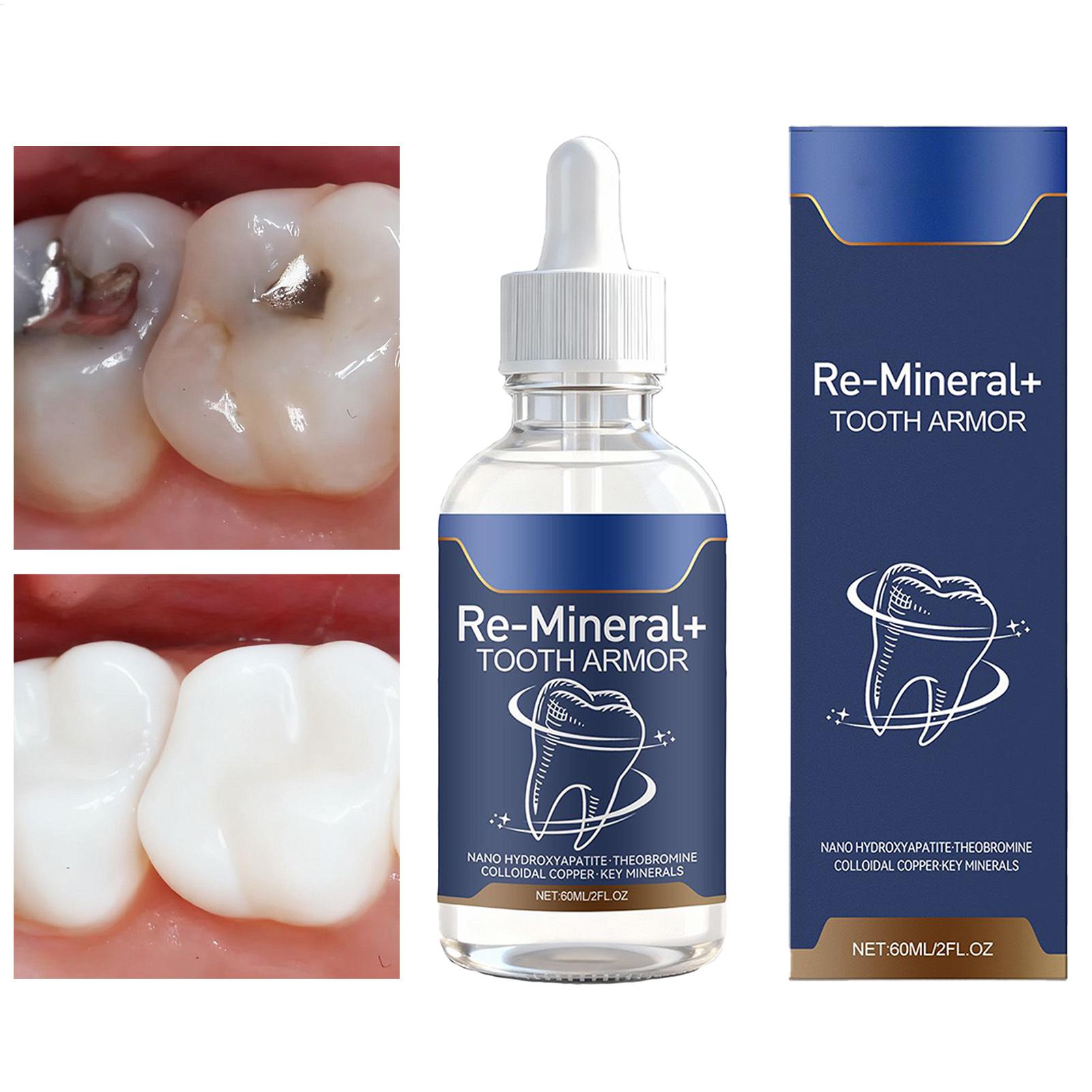 Teeth Whitening And Stain Removal - 60ml Teeth Cleaning Liquid Removes Tooth