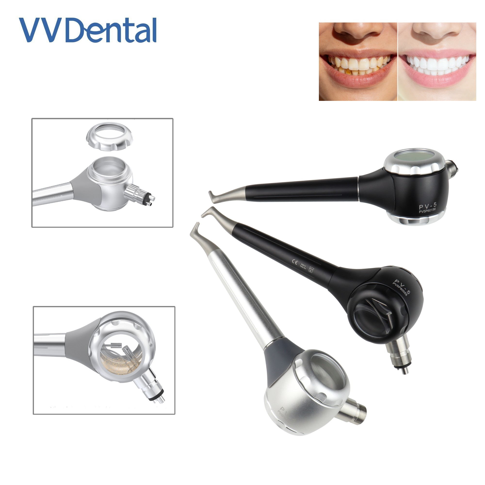 Teeth Whitening Free - VV Dental 2/4 Holes Teeth Whitening