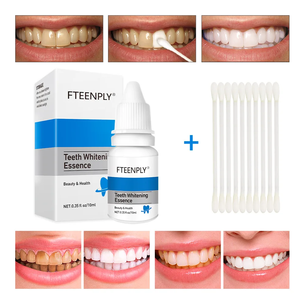 Teeth Whitening Results - FTEENPLY Làm Trắng Răng Tinh Chất