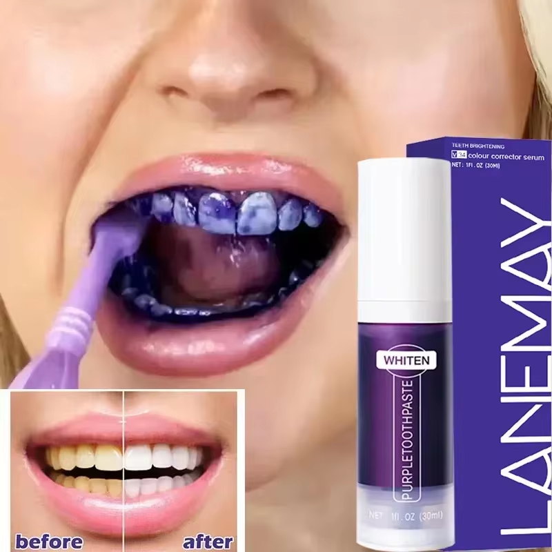 Teeth Whitening Crest - V34 Purple Teeth Whitening Toothpaste Remove
