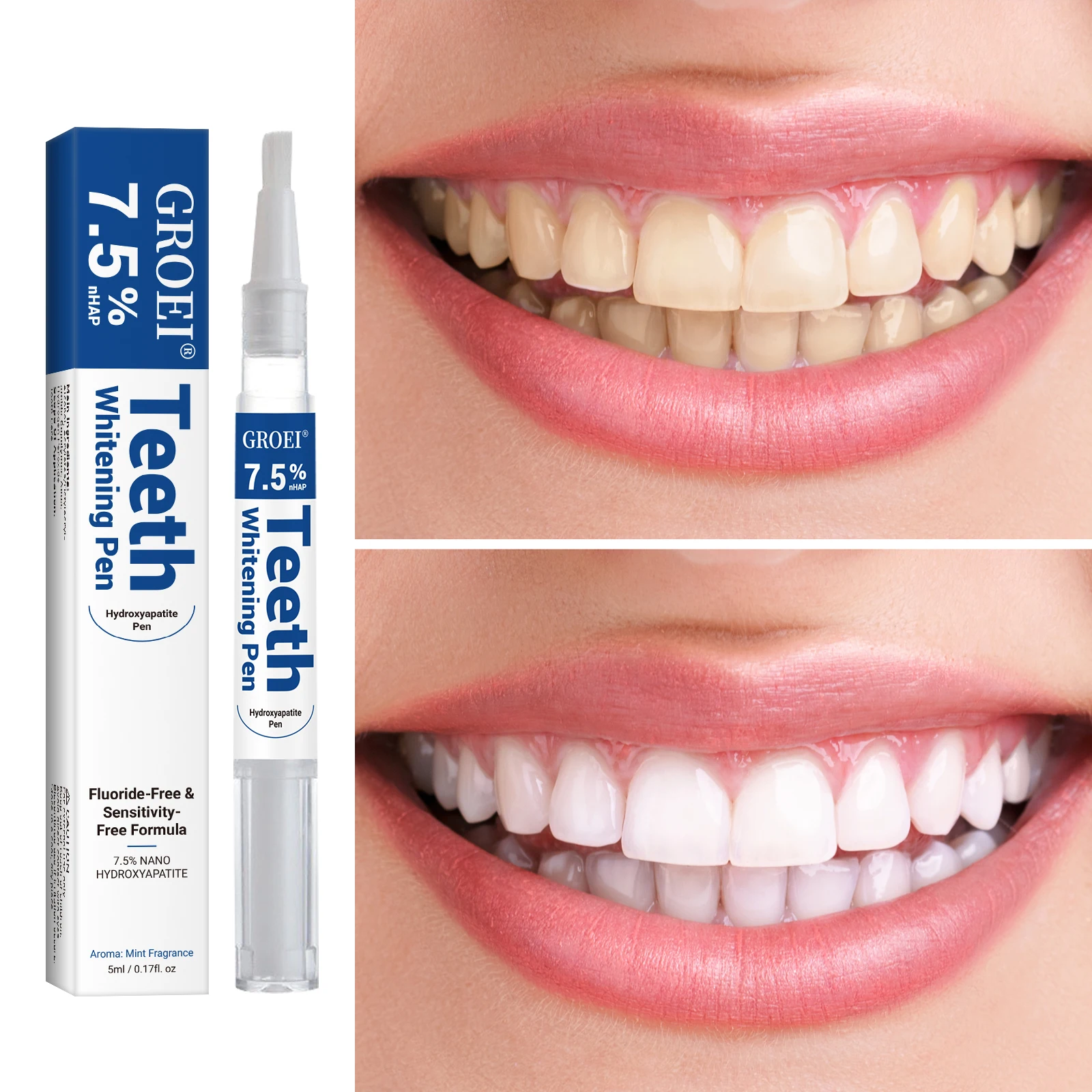 Hydroxyapatite Tooth Whitening - đánh giá và giá Teeth Whitening Before And After