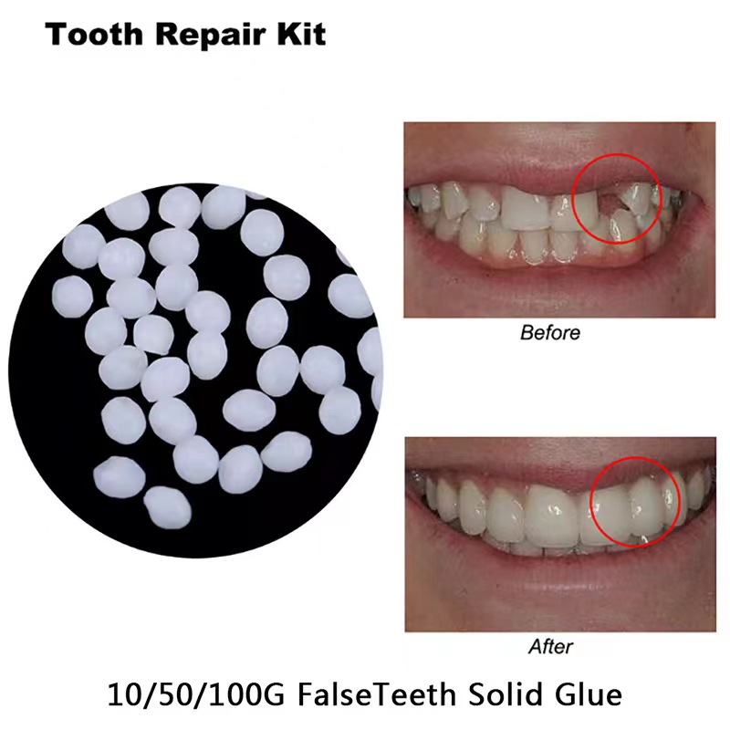 10g/bag Tooth Repair Kit-therm - đánh giá và giá Teeth Whitening Mask