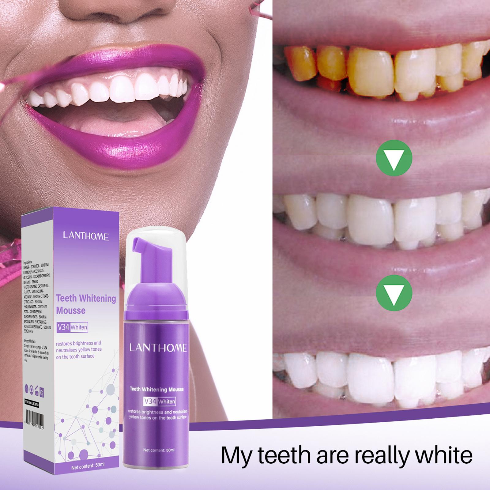 V34 Mousse Teeth Cleaning Toot - đánh giá và giá Teeth Whitening Crest