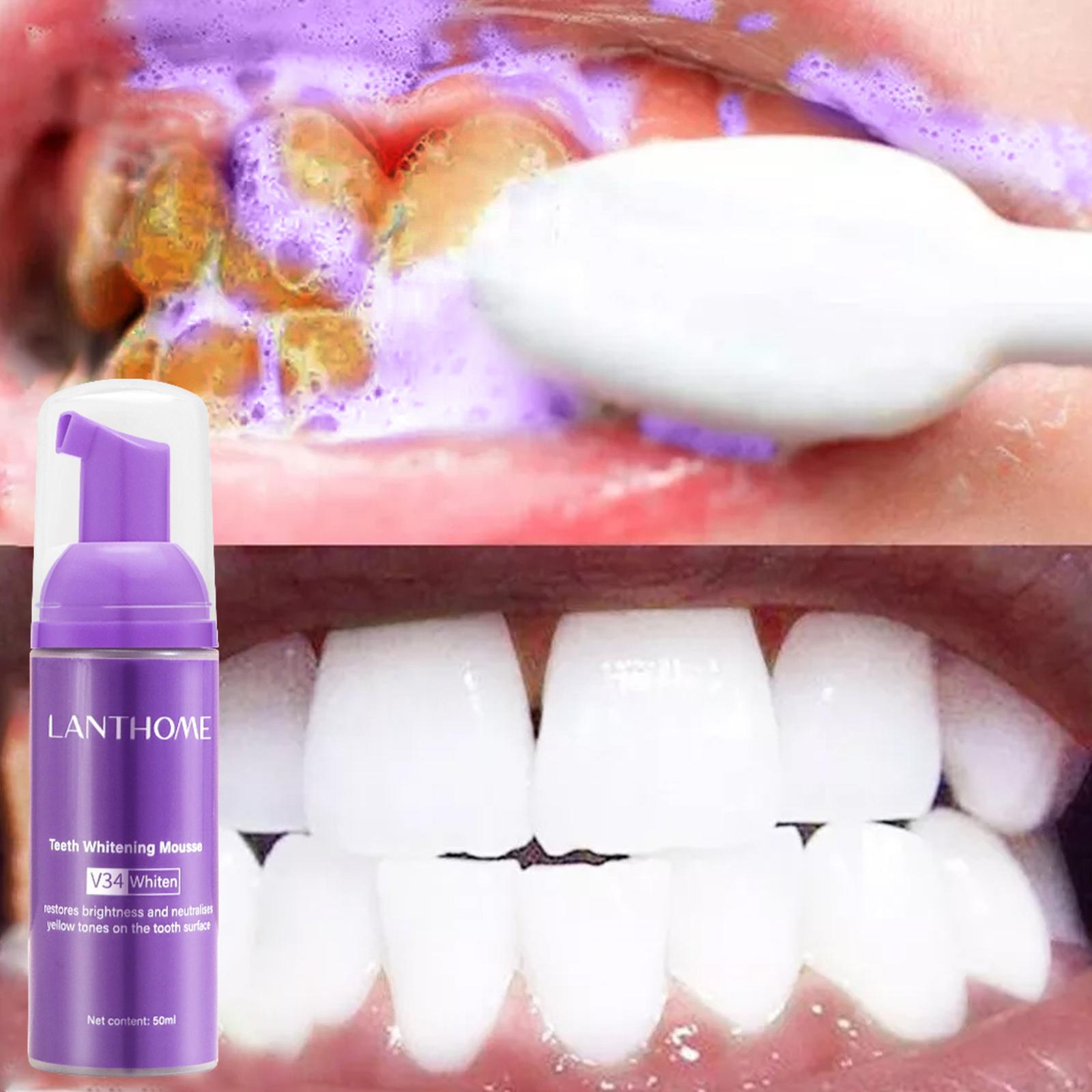 V34 Mousse Teeth Cleaning Toot - đánh giá và giá Teeth Whitening Crest