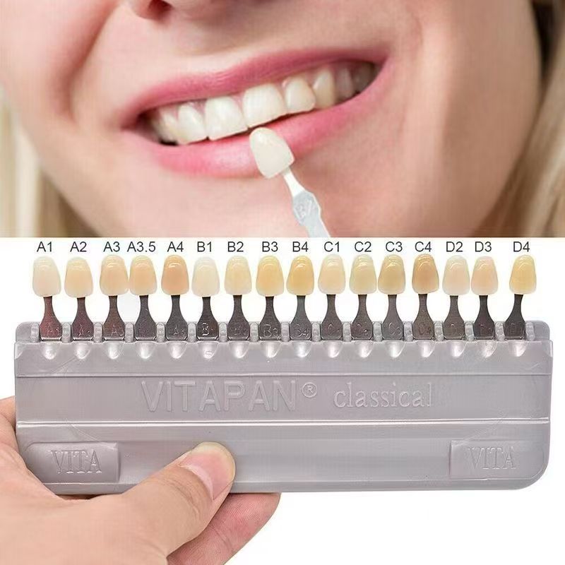 VITA 16 Colors Teeth Shade Gui - đánh giá và giá Teeth Whitening Shade Guide
