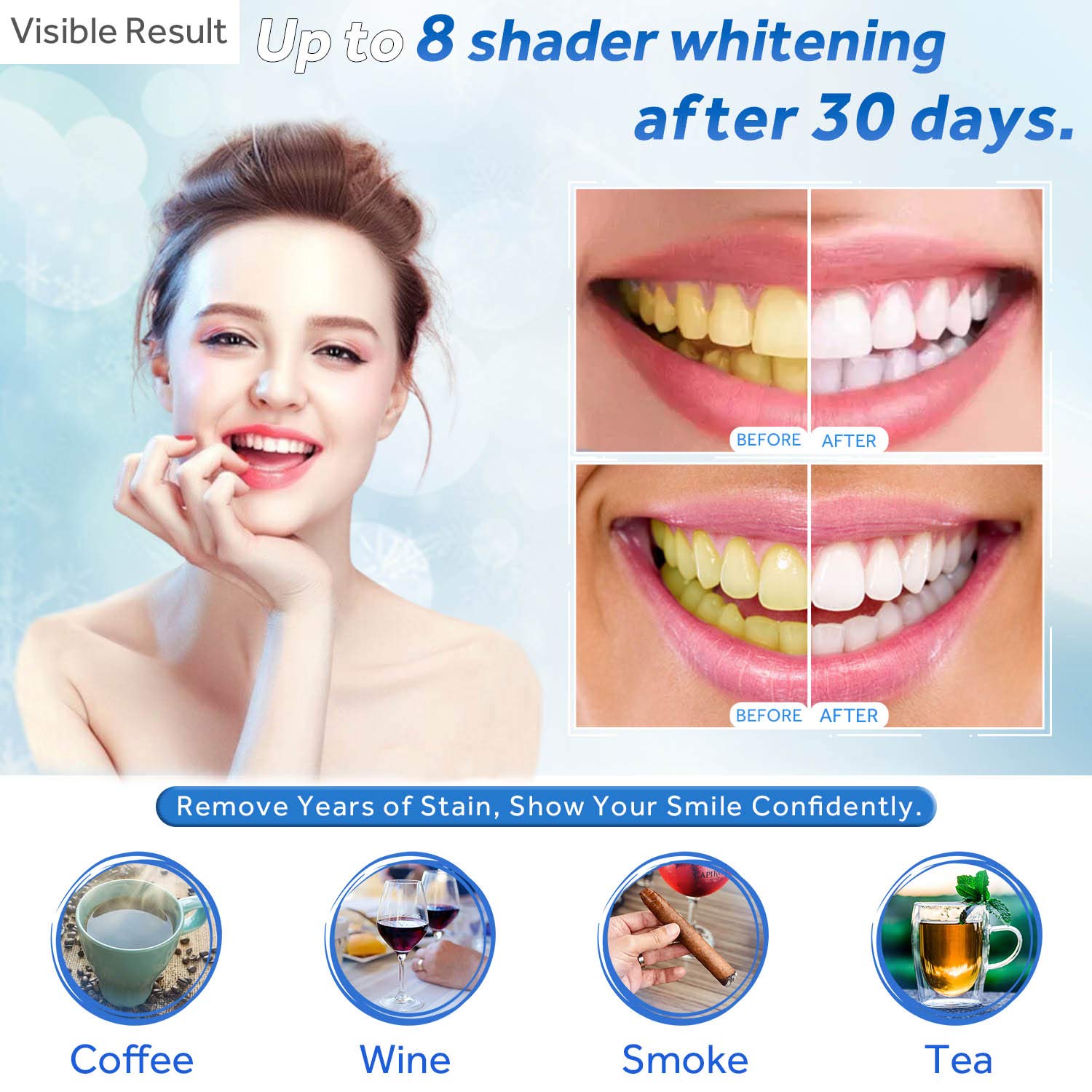 Teeth Whitening Gel Refill Syr - đánh giá và giá Teeth Whitening Before And After