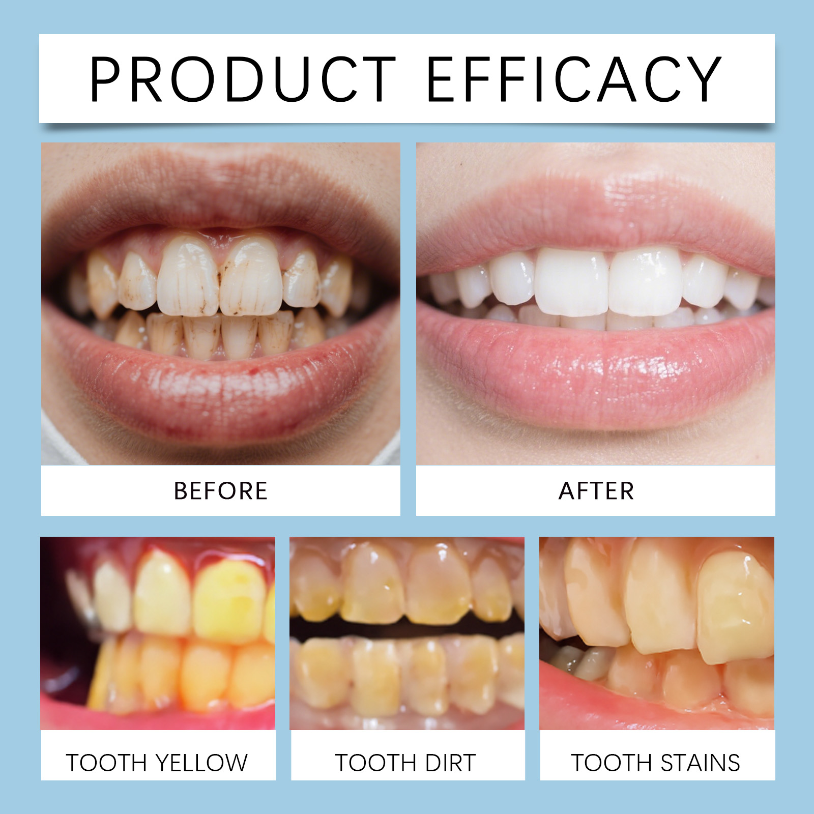 Feimuko 8ml Teeth Gel Pen Gent - đánh giá và giá Teeth Whitening Gel Pen