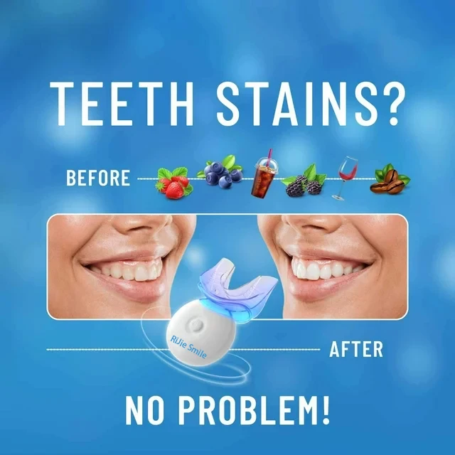 High Quality Cleaning Kit Wire - đánh giá và giá Teeth Whitening At Home Kit