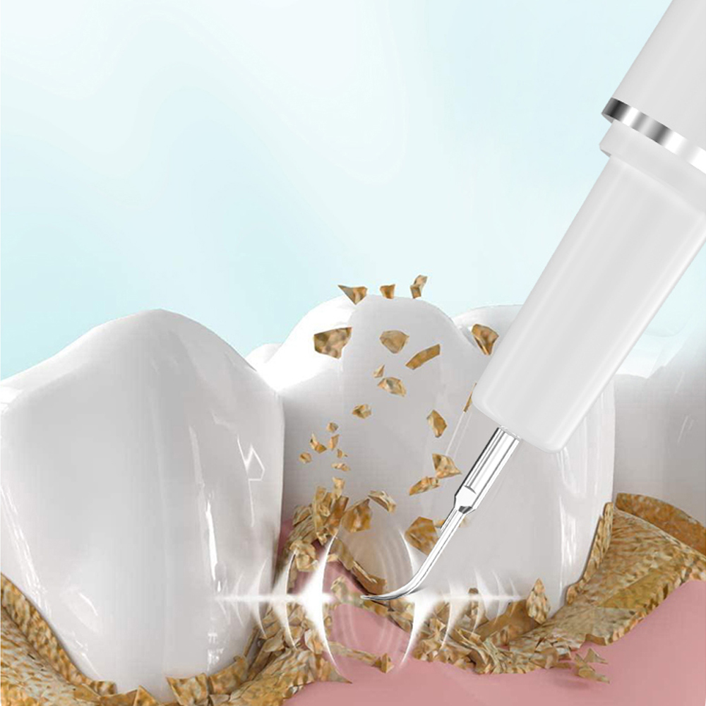 LC-H156X Electric Teeth Whiten - đánh giá và giá Teeth Whitening And Stain Removal