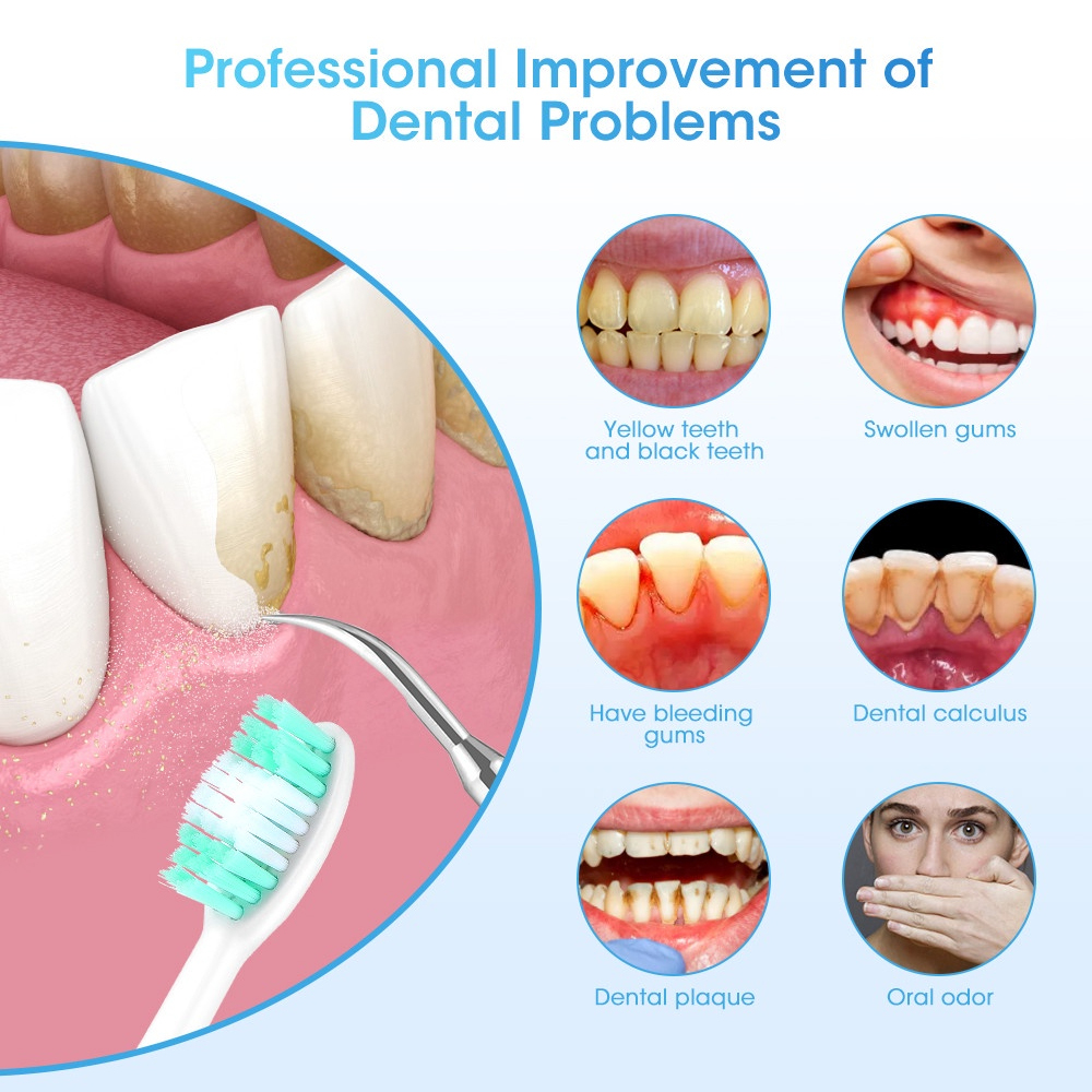 LC-H156X Electric Teeth Whiten - đánh giá và giá Teeth Whitening And Stain Removal