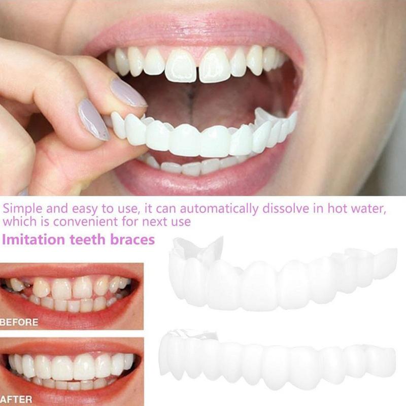 Snap On Teeth Veneers Instant  - đánh giá và giá Teeth Whitening Mask