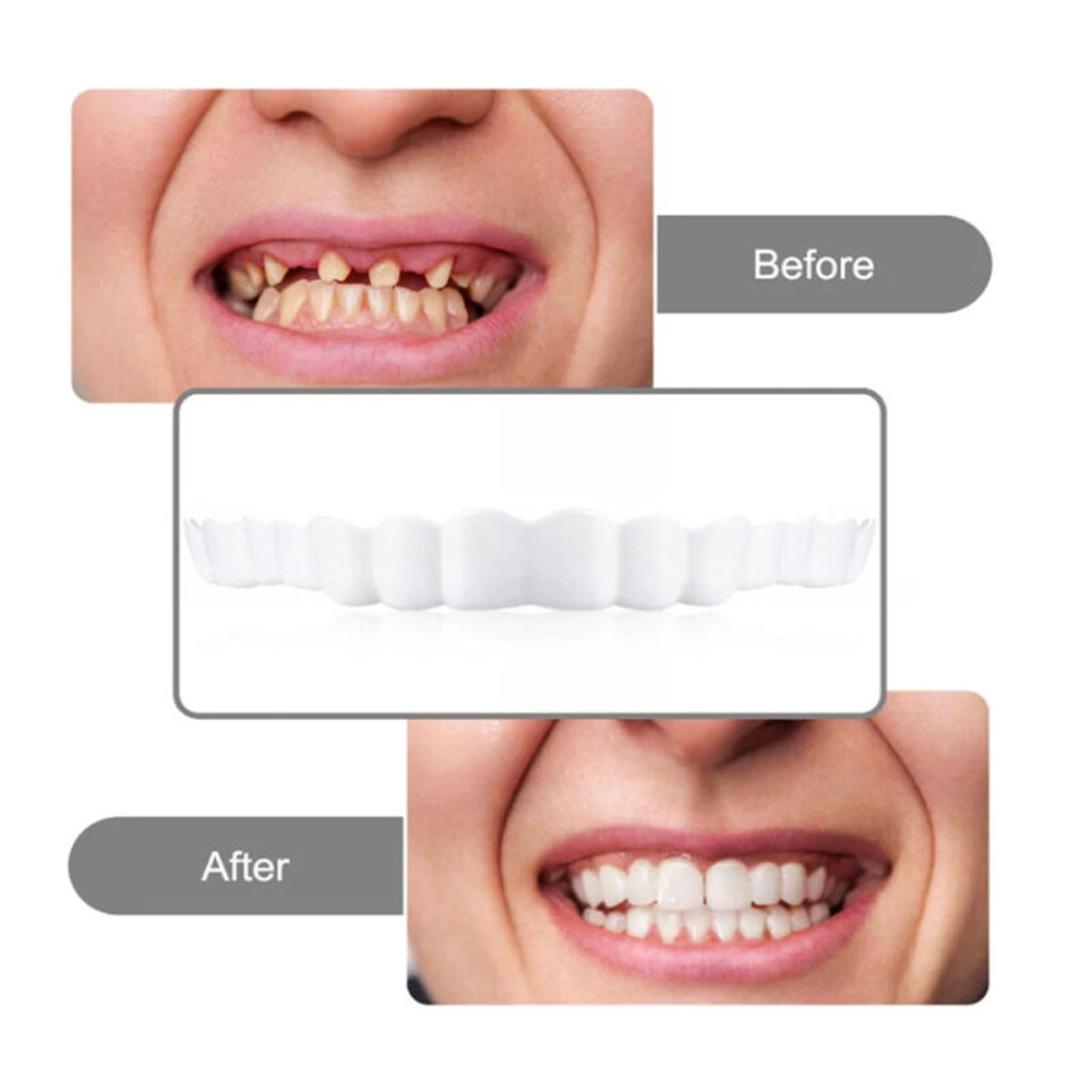 4-6 Pairs Upper&Lower Jaw Dent - đánh giá và giá Teeth Whitening Mask