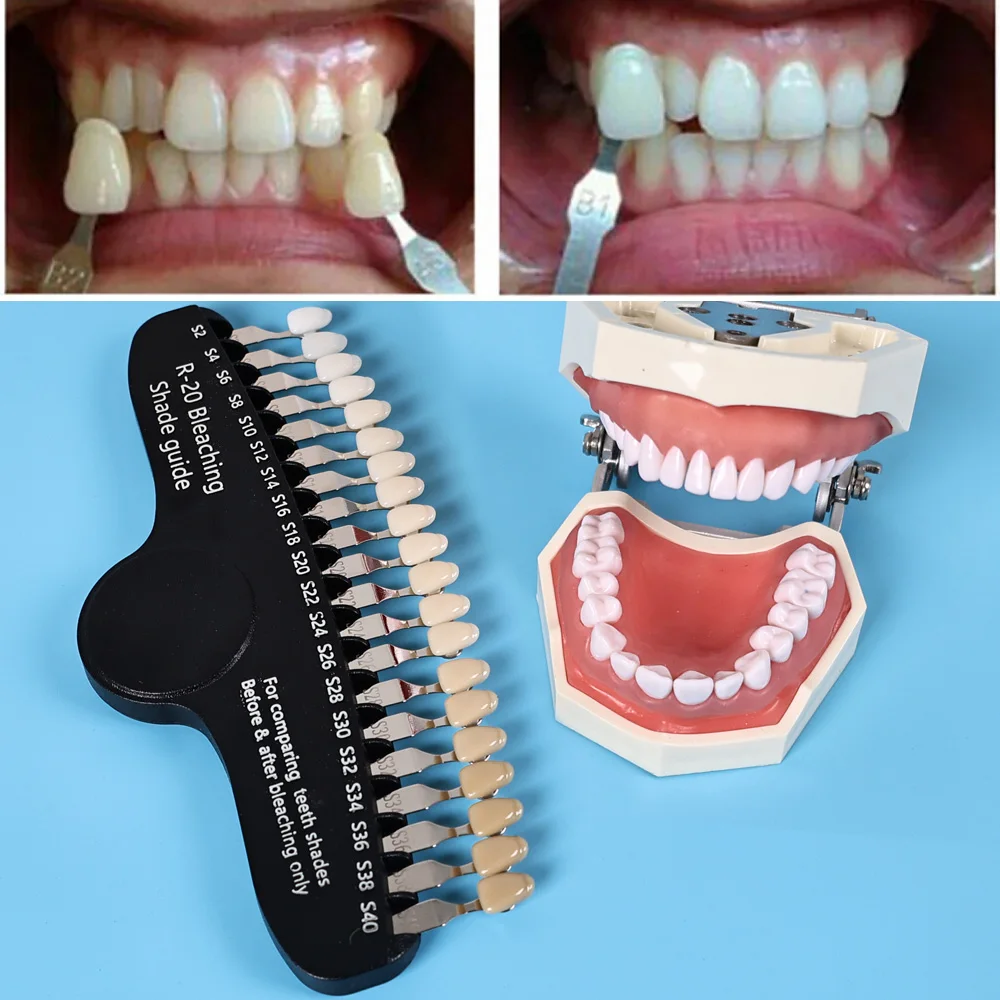 ELIJAH R-20 Bleaching Shade Gu - đánh giá và giá Teeth Whitening Shade Guide