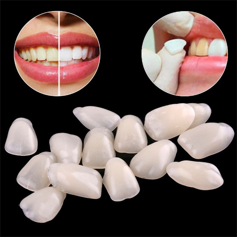 Temporary Dental Veneers - Ult - đánh giá và giá Teeth Whitening Mask