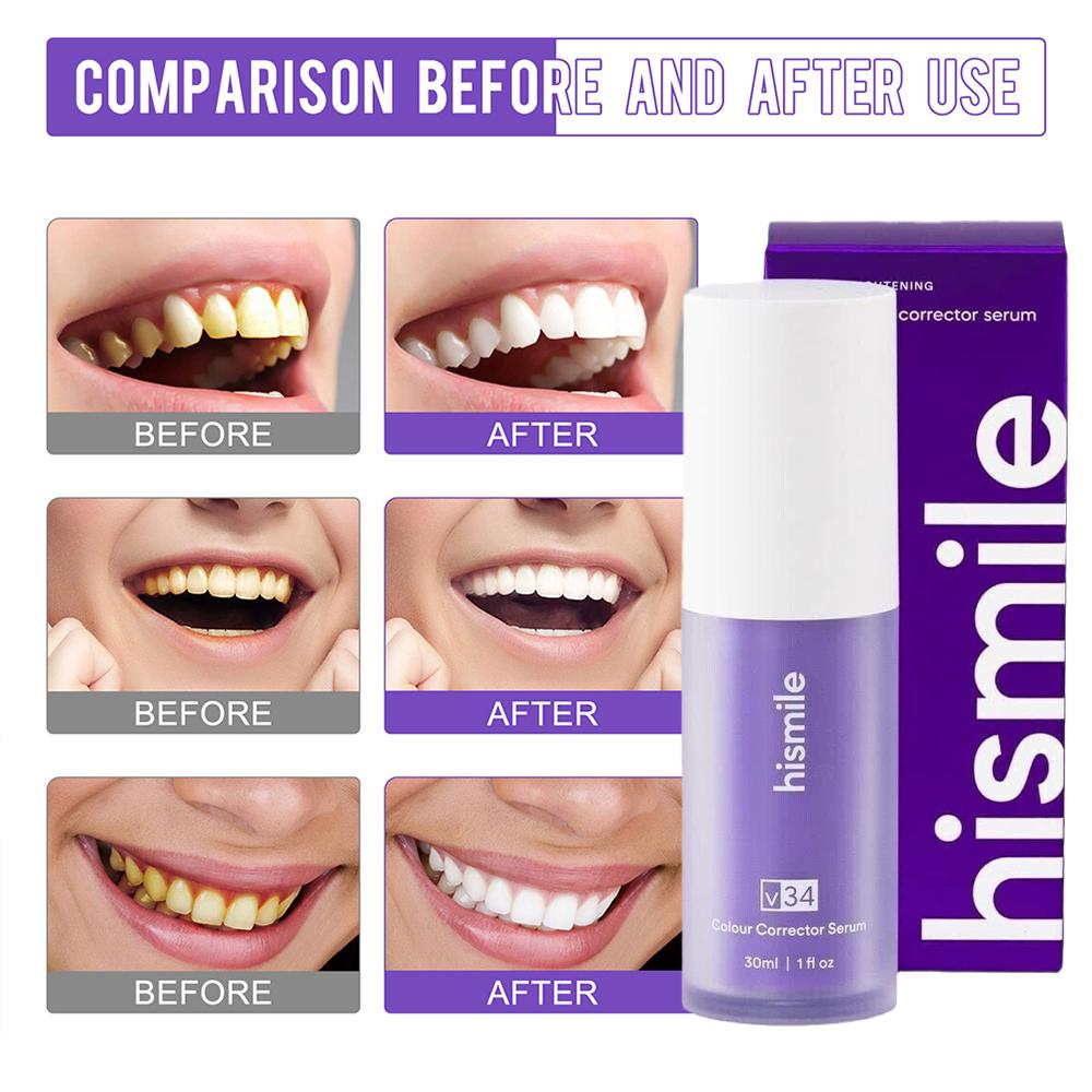  Purple V34 Hismile Teeth Bri - đánh giá và giá Teeth Whitening Crest