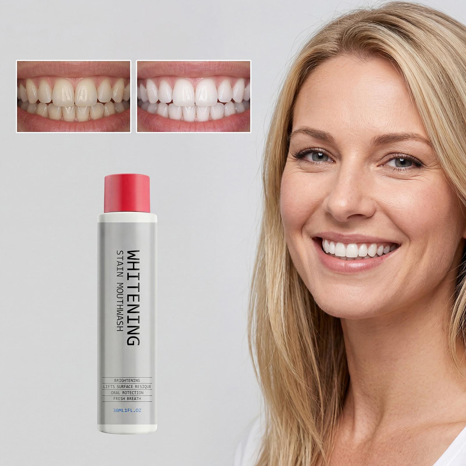 30ml Stain Whitening Mouthwash - đánh giá và giá Teeth Whitening And Stain Removal