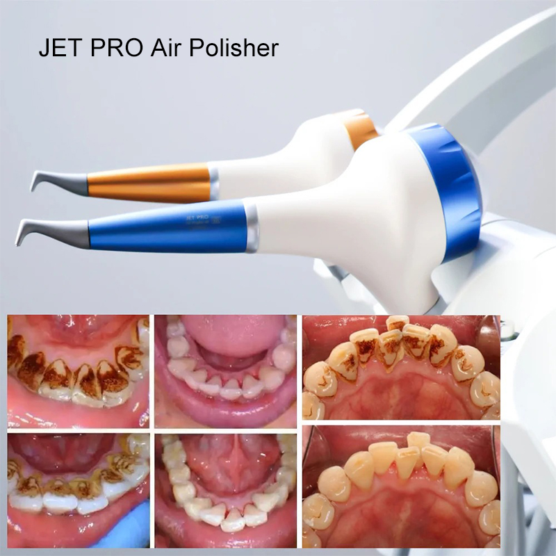 VV Dental  Air Polishing Proph - đánh giá và giá Teeth Whitening Free