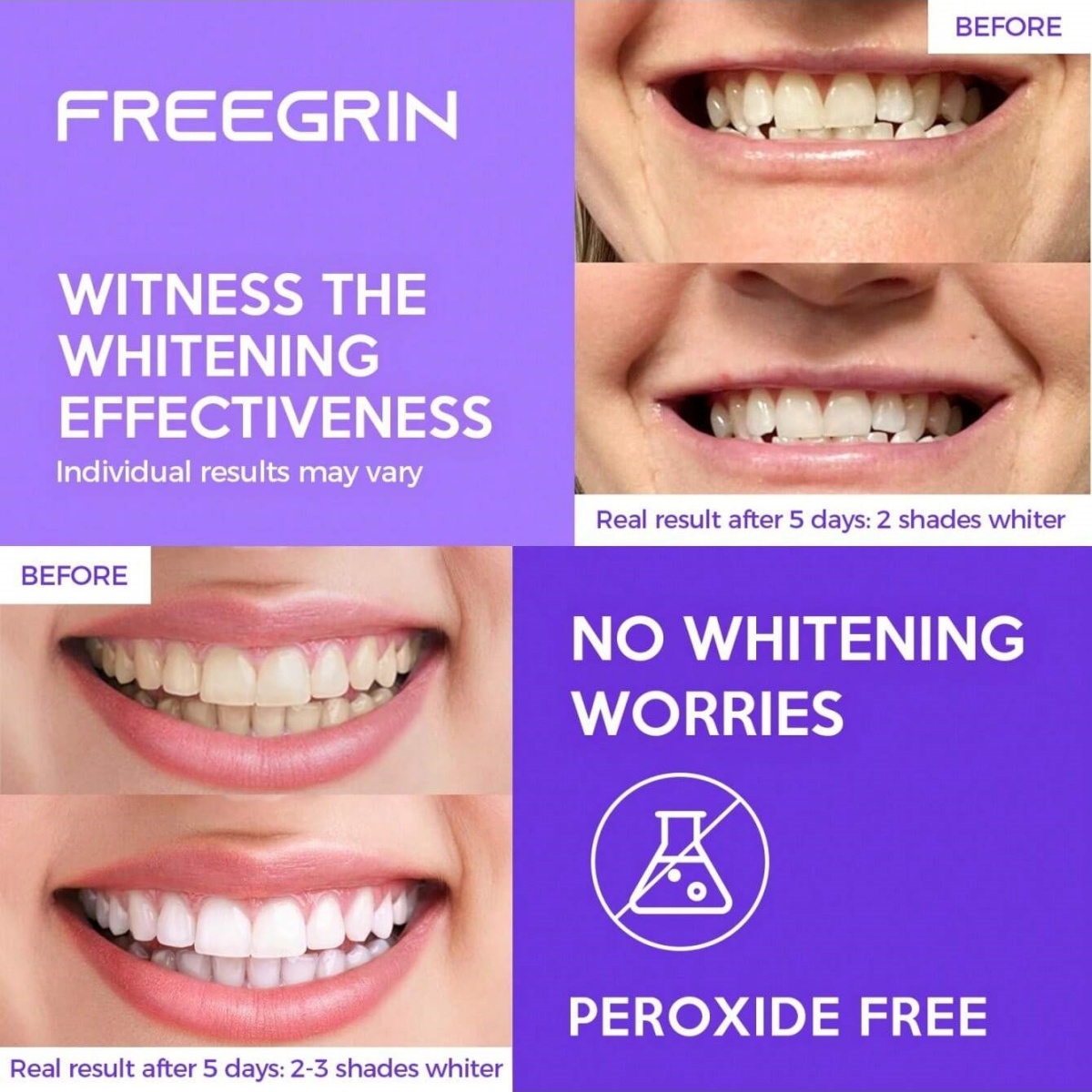 Deluxe Whitening Teeth Sticker - đánh giá và giá Teeth Whitening Before And After