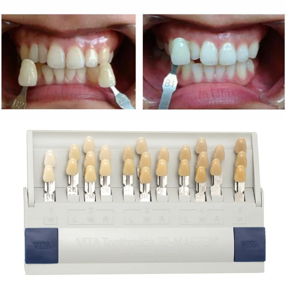 Vita 3D Master Dental Lab Blea - đánh giá và giá Teeth Whitening Shade Guide