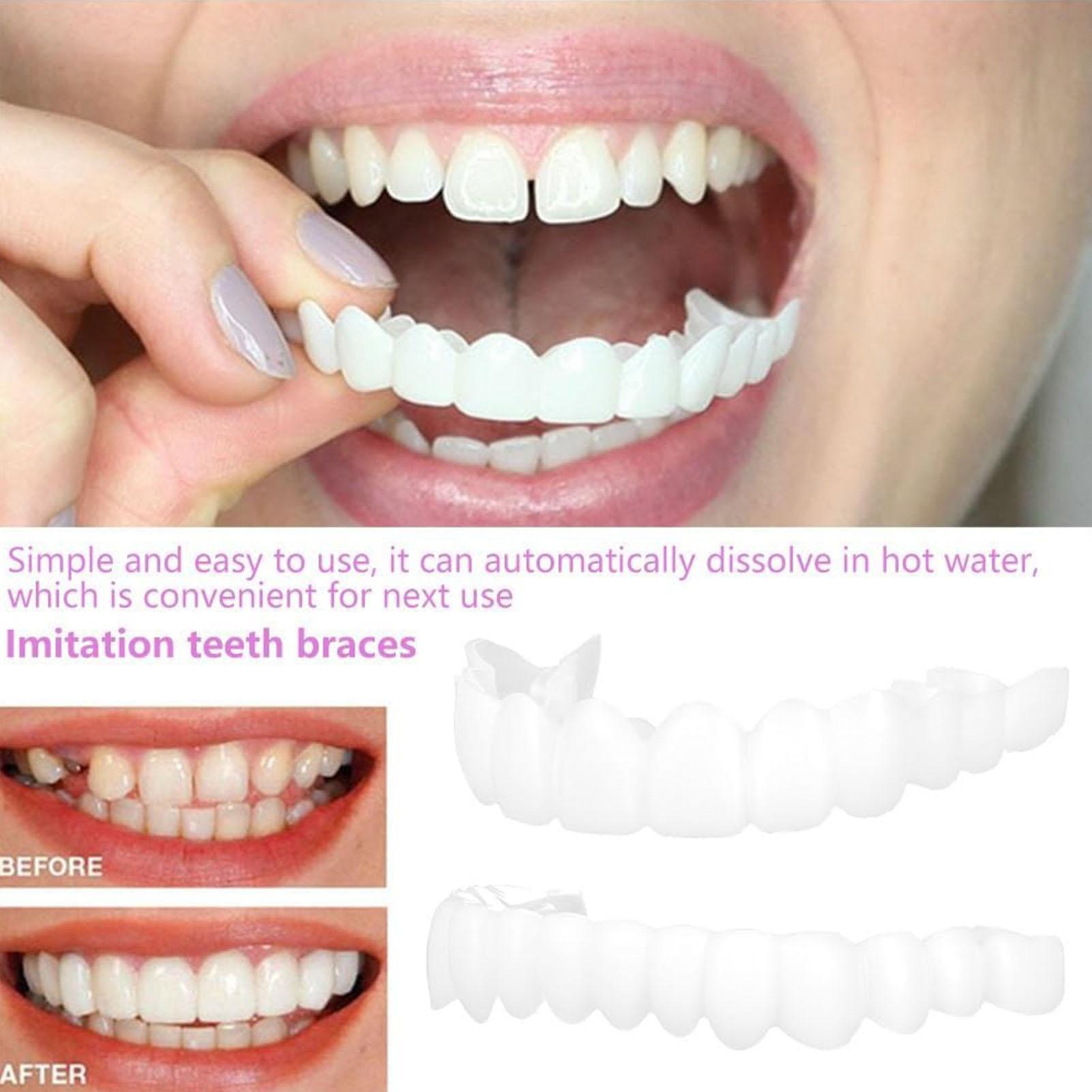 2pcs Men Women Temporary Teeth - đánh giá và giá Teeth Whitening Mask