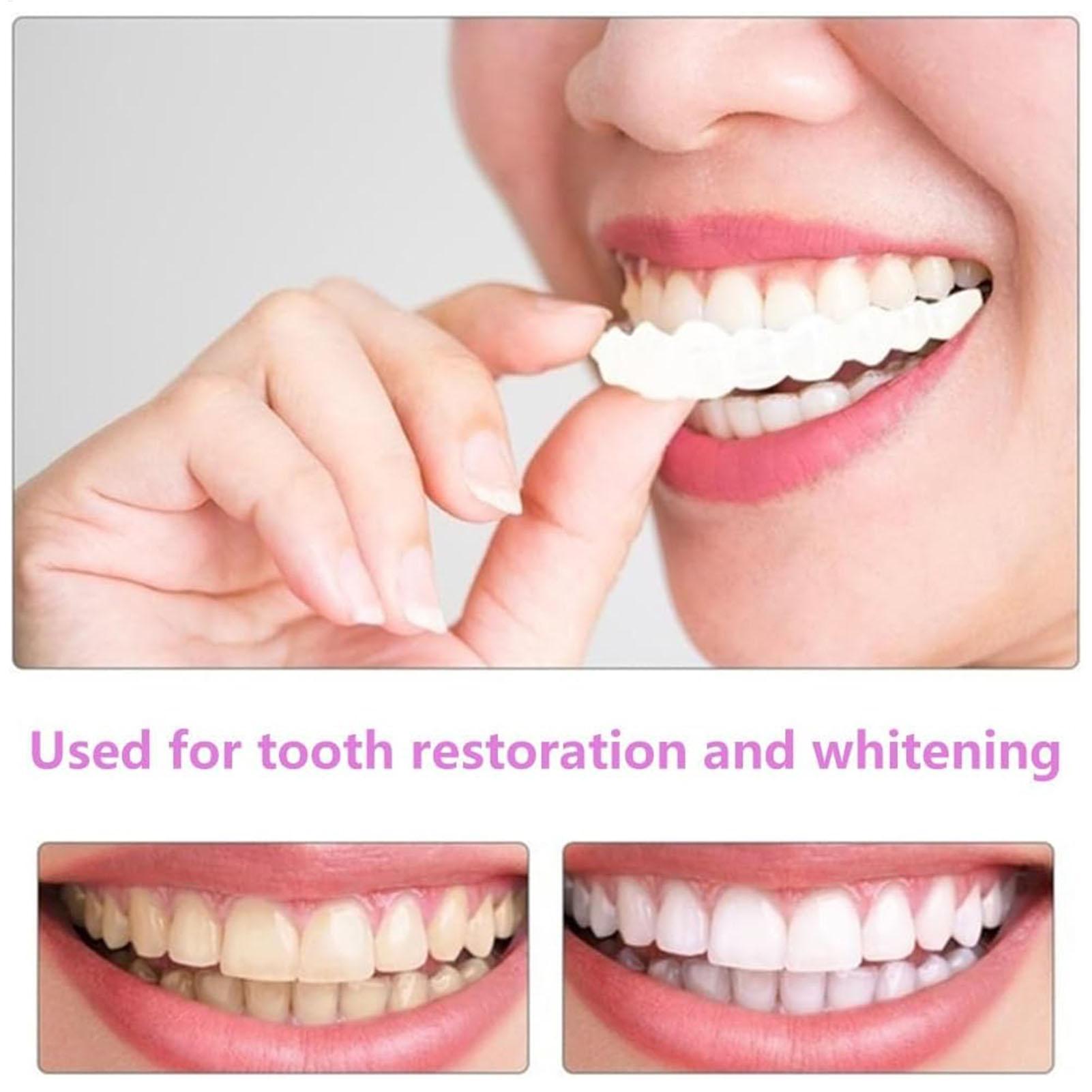 2pcs Men Women Temporary Teeth - đánh giá và giá Teeth Whitening Mask