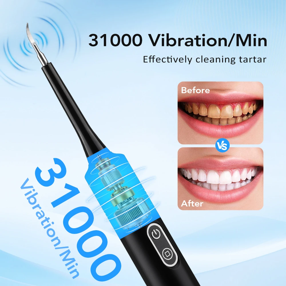 Electric Sonic Vibration Denta - đánh giá và giá Teeth Whitening And Stain Removal