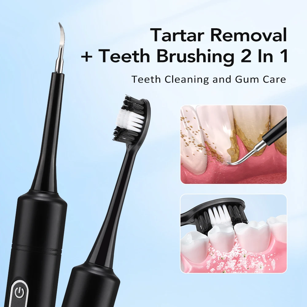 Electric Sonic Vibration Denta - đánh giá và giá Teeth Whitening And Stain Removal