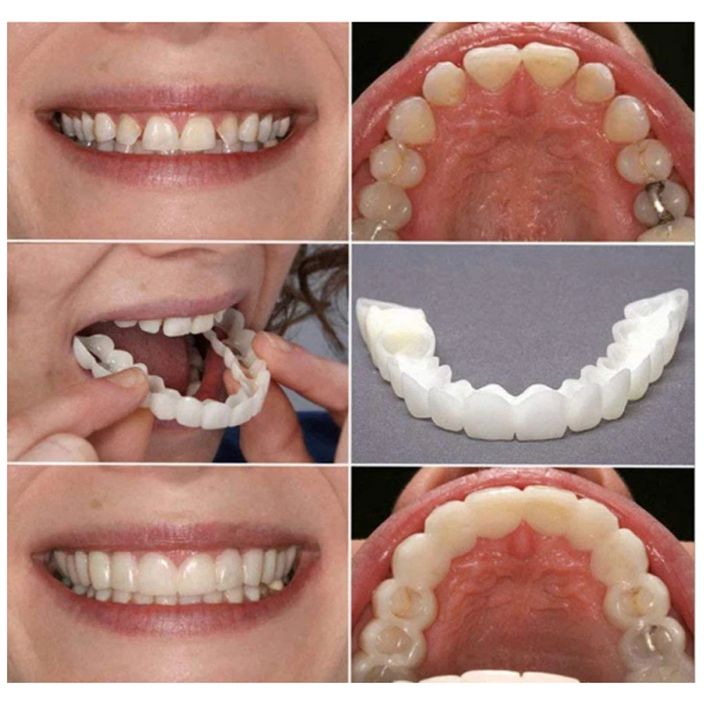 2 Pairs Dentures Teeth Denture - đánh giá và giá Teeth Whitening Mask